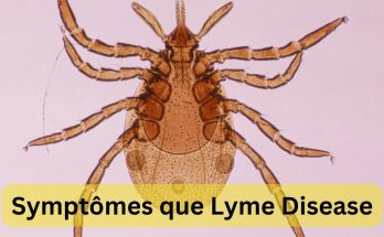 Symptômes que Lyme Disease vous ne devriez vraiment pas ignorer