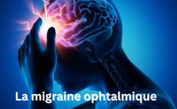 La migraine ophtalmique