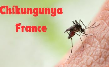 Chikungunya France : Causes, maladie, symptômes