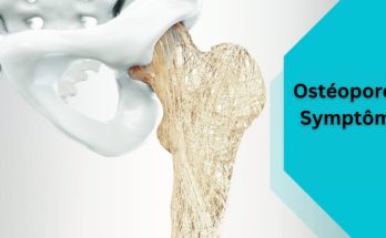 Qu'est-ce que l'ostéoporose symptômes - causes